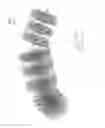 Fig. 53 - Embolisation systems