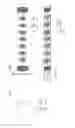 Fig. 90 - Embolisation systems