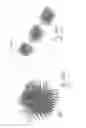 Fig. 93 - Embolisation systems
