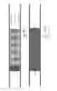 Fig. 98 - Embolisation systems
