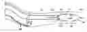 Fig. 01 - REMOVABLE LUNG REDUCTION DEVICES, SYSTEMS, AND METHODS