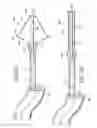 Fig. 08 - REMOVABLE LUNG REDUCTION DEVICES, SYSTEMS, AND METHODS