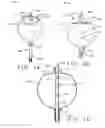 Fig. 03 - Expandable body device and method of use