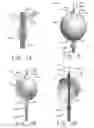 Fig. 06 - Expandable body device and method of use