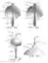 Fig. 16 - Expandable body device and method of use