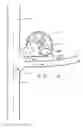 Fig. 28 - Expandable body device and method of use