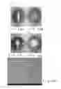 Fig. 47 - Expandable body device and method of use