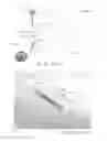 Fig. 50 - Expandable body device and method of use