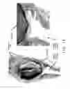 Fig. 56 - Expandable body device and method of use