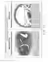 Fig. 58 - Expandable body device and method of use