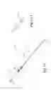 Fig. 02 - Endovascular occlusion device with hemodynamically enhanced sealing and anchoring