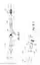 Fig. 07 - Endovascular occlusion device with hemodynamically enhanced sealing and anchoring