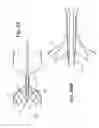 Fig. 16 - Endovascular occlusion device with hemodynamically enhanced sealing and anchoring