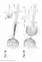 Fig. 23 - Endovascular occlusion device with hemodynamically enhanced sealing and anchoring