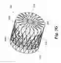 Fig. 32 - Endovascular occlusion device with hemodynamically enhanced sealing and anchoring