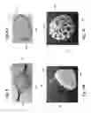 Fig. 35 - Endovascular occlusion device with hemodynamically enhanced sealing and anchoring
