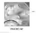 Fig. 43 - Endovascular occlusion device with hemodynamically enhanced sealing and anchoring