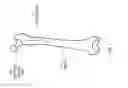Fig. 02 - Bone perforator