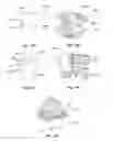 Fig. 16 - Patient-matched apparatus and methods for performing surgical procedures