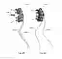 Fig. 34 - Patient-matched apparatus and methods for performing surgical procedures