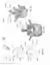 Fig. 47 - Patient-matched apparatus and methods for performing surgical procedures