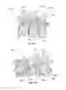 Fig. 52 - Patient-matched apparatus and methods for performing surgical procedures