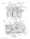 Fig. 53 - Patient-matched apparatus and methods for performing surgical procedures