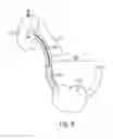 Fig. 06 - SYSTEM AND METHOD FOR GUIDED REMOVAL FROM AN IN VIVO SUBJECT