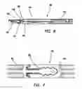 Fig. 06 - Laparoscopic scissors