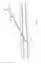 Fig. 04 - CANNULA ASSEMBLY