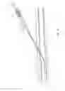 Fig. 05 - CANNULA ASSEMBLY