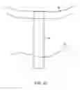 Fig. 06 - SYSTEM AND METHOD FOR TRANSAPICAL ACCESS AND CLOSURE