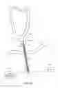 Fig. 32 - SYSTEM AND METHOD FOR TRANSAPICAL ACCESS AND CLOSURE