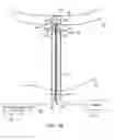 Fig. 35 - SYSTEM AND METHOD FOR TRANSAPICAL ACCESS AND CLOSURE