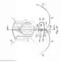 Fig. 03 - Externally applied intrapartum support device