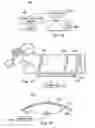 Fig. 22 - Externally applied intrapartum support device