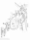 Fig. 23 - Externally applied intrapartum support device