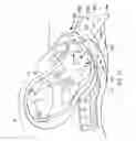 Fig. 28 - Externally applied intrapartum support device