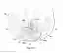 Fig. 30 - Externally applied intrapartum support device