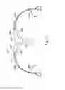 Fig. 34 - Externally applied intrapartum support device
