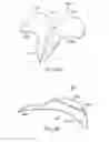 Fig. 41 - Externally applied intrapartum support device