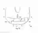 Fig. 44 - Externally applied intrapartum support device