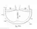 Fig. 46 - Externally applied intrapartum support device