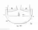 Fig. 47 - Externally applied intrapartum support device