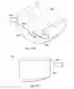 Fig. 49 - Externally applied intrapartum support device