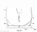 Fig. 50 - Externally applied intrapartum support device