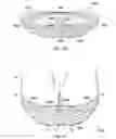 Fig. 52 - Externally applied intrapartum support device