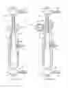 Fig. 03 - External fixator strut