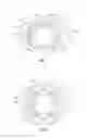 Fig. 06 - Orthopedic fixation devices and methods of installation thereof