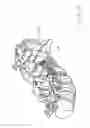 Fig. 31 - Apparatus and devices for percutaneously extending an existing spinal construct